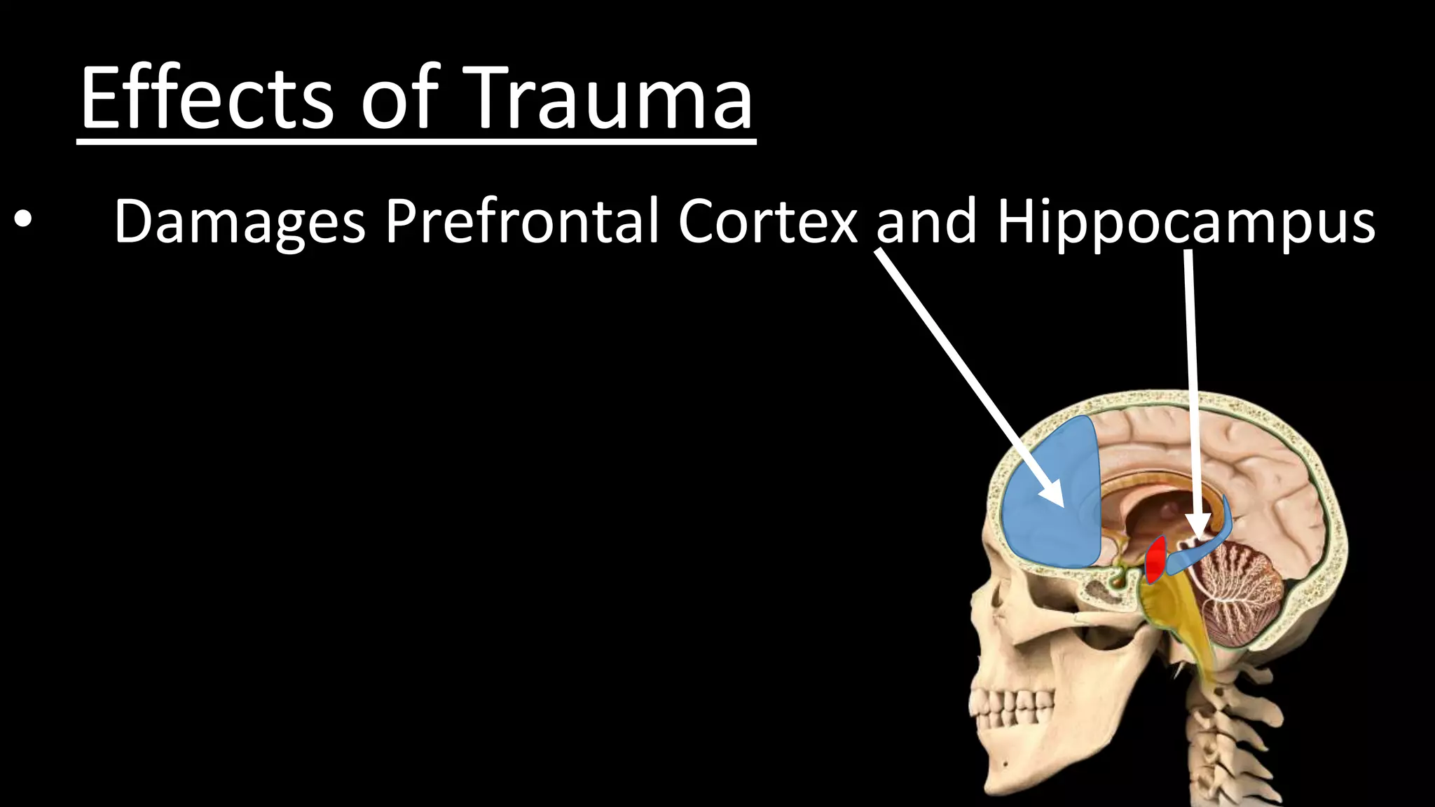 Effects of Trauma
• Damages Prefrontal Cortex and Hippocampus
 