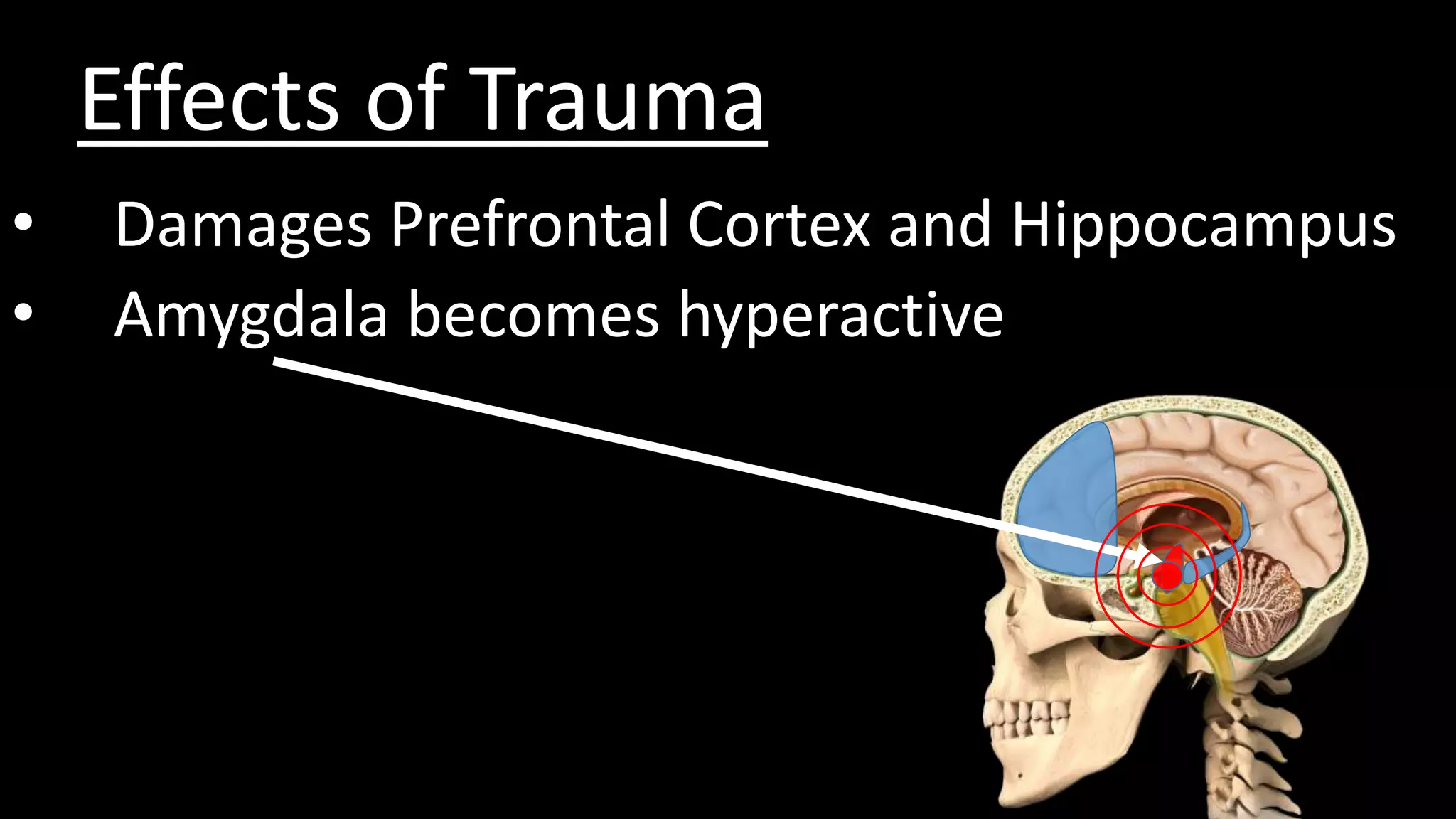 Effects of Trauma
• Damages Prefrontal Cortex and Hippocampus
• Amygdala becomes hyperactive
 