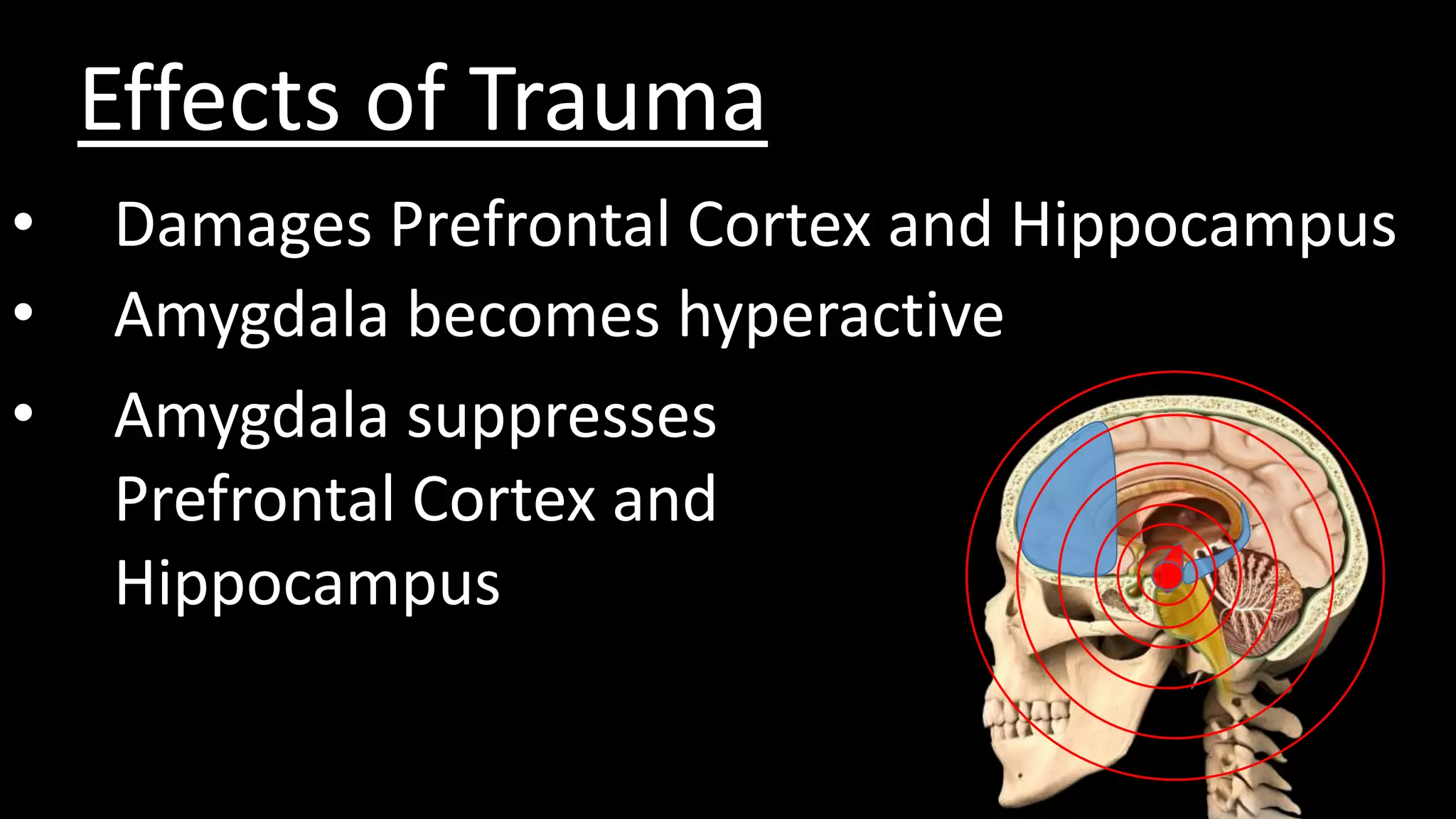 Effects of Trauma
• Damages Prefrontal Cortex and Hippocampus
• Amygdala becomes hyperactive
• Amygdala suppresses
Prefrontal Cortex and
Hippocampus
 