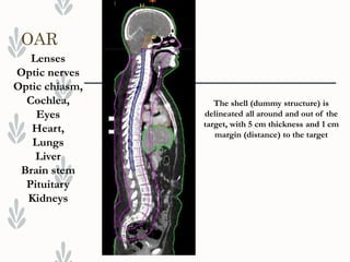 Alawi treatment planning-evaluation-of-volumetric-modulated-arc-therapy ...