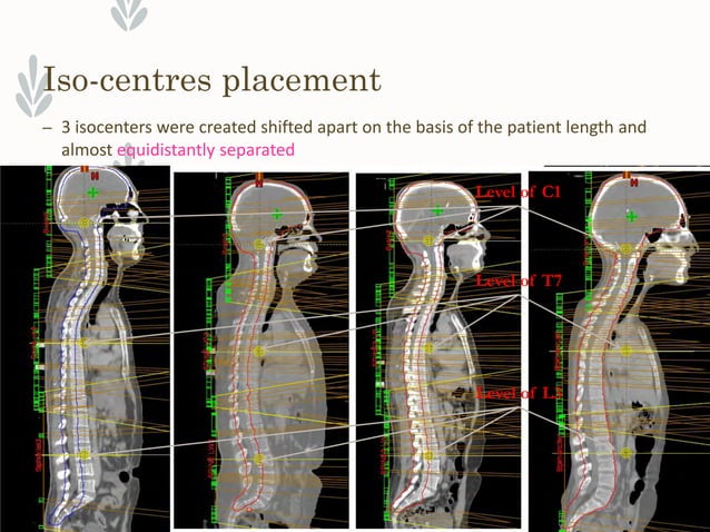 Alawi treatment planning-evaluation-of-volumetric-modulated-arc-therapy ...