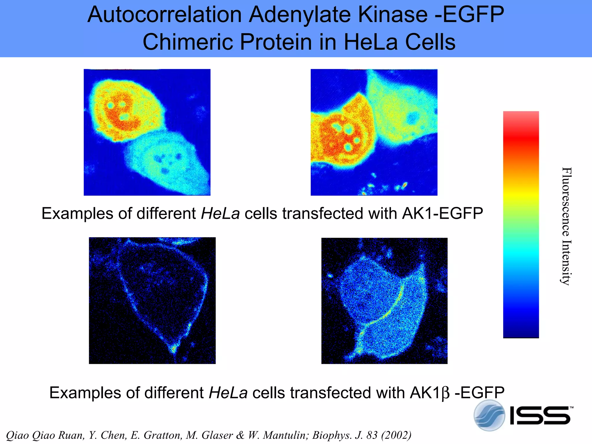 Autocorrelation Adenylate Kinase -EGFP
                     Chimeric Protein in HeLa Cells




                                                                                      Fluorescence Intensity
       Examples of different HeLa cells transfected with AK1-EGFP




        Examples of different HeLa cells transfected with AK1β -EGFP

Qiao Qiao Ruan, Y. Chen, E. Gratton, M. Glaser & W. Mantulin; Biophys. J. 83 (2002)
 