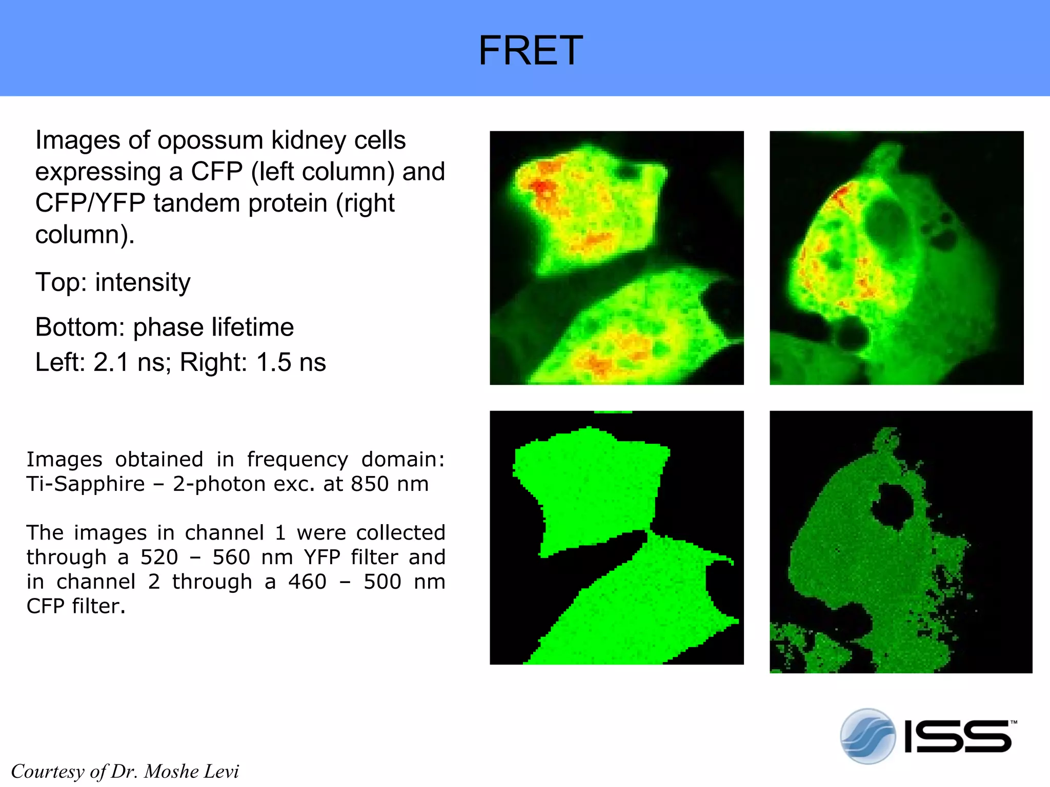 FRET

  Images of opossum kidney cells
  expressing a CFP (left column) and
  CFP/YFP tandem protein (right
  column).
  Top: intensity
  Bottom: phase lifetime
  Left: 2.1 ns; Right: 1.5 ns


 Images obtained in frequency domain:
 Ti-Sapphire – 2-photon exc. at 850 nm

 The images in channel 1 were collected
 through a 520 – 560 nm YFP filter and
 in channel 2 through a 460 – 500 nm
 CFP filter.




Courtesy of Dr. Moshe Levi
 