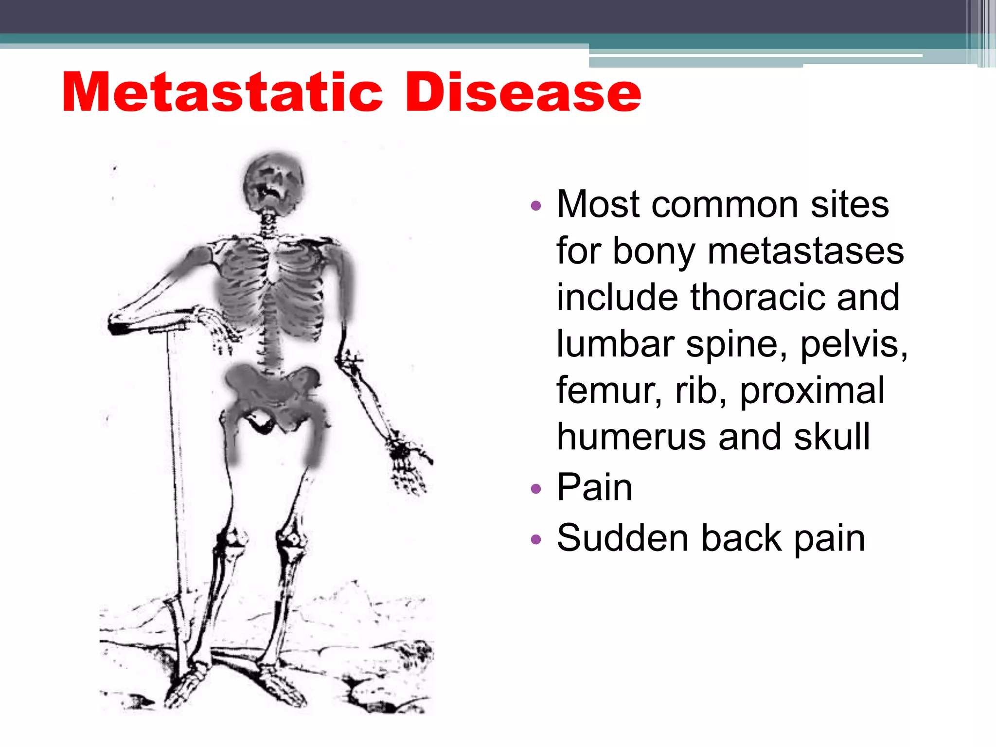 Metastatic Disease
• Most common sites
for bony metastases
include thoracic and
lumbar spine, pelvis,
femur, rib, proximal
humerus and skull
• Pain
• Sudden back pain
 