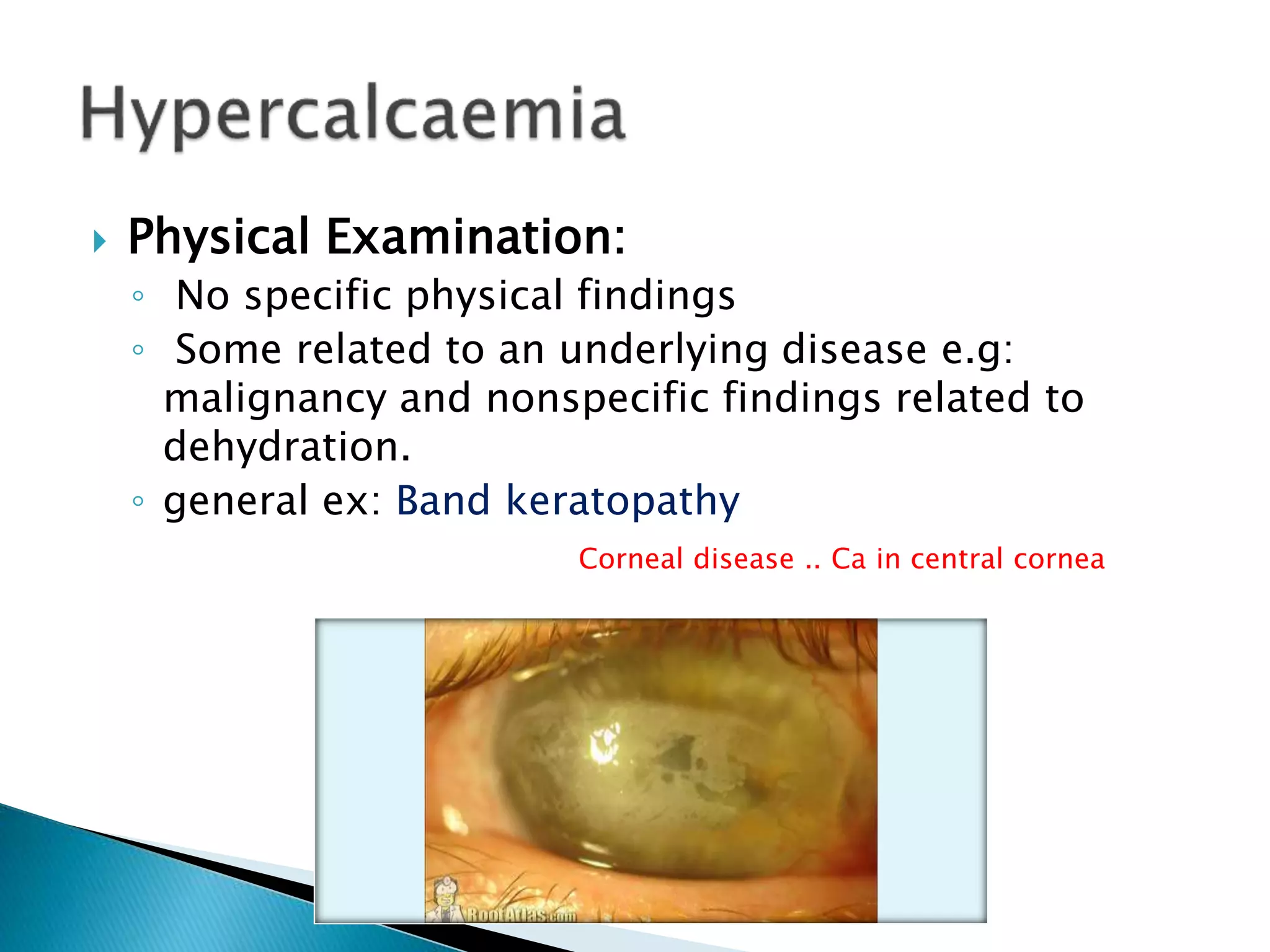  Physical Examination:
◦ No specific physical findings
◦ Some related to an underlying disease e.g:
malignancy and nonspecific findings related to
dehydration.
◦ general ex: Band keratopathy
Corneal disease .. Ca in central cornea
 