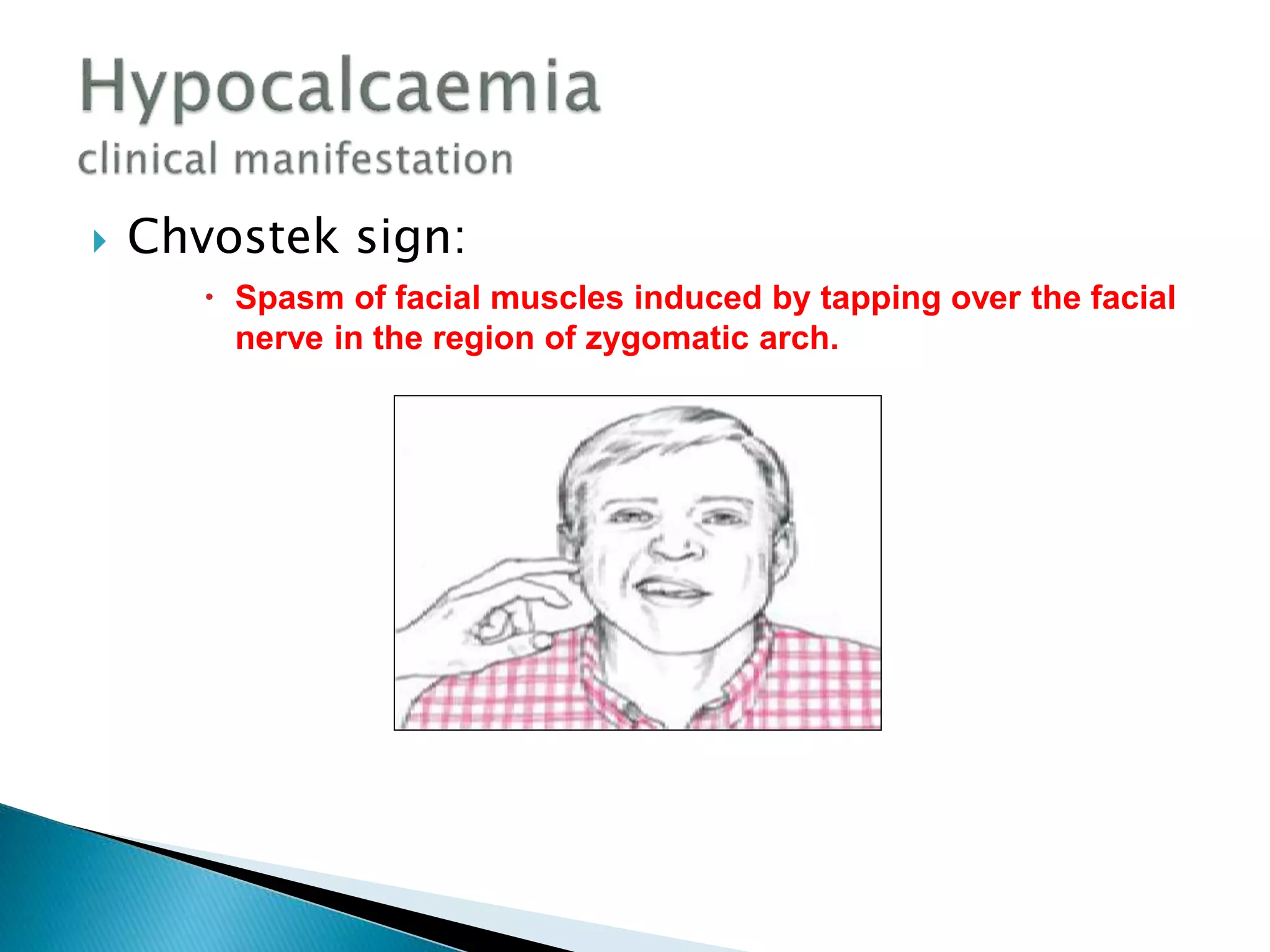  Chvostek sign:
 Spasm of facial muscles induced by tapping over the facial
nerve in the region of zygomatic arch.
 