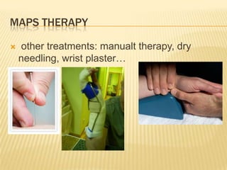 MAPS THERAPY
 other treatments: manualt therapy, dry
needling, wrist plaster…
 