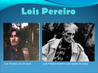 Lois Pereiro con 20 anos Lois Pereiro enfermo polo aceite de colza 