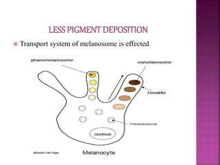  Transport system of melanosome is effected
 