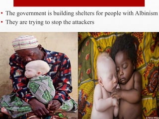 • The government is building shelters for people with Albinism
• They are trying to stop the attackers
 