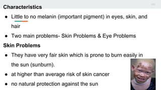 Albinism | PPTX