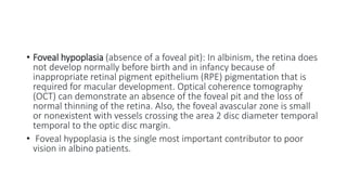 • Foveal hypoplasia (absence of a foveal pit): In albinism, the retina does
not develop normally before birth and in infancy because of
inappropriate retinal pigment epithelium (RPE) pigmentation that is
required for macular development. Optical coherence tomography
(OCT) can demonstrate an absence of the foveal pit and the loss of
normal thinning of the retina. Also, the foveal avascular zone is small
or nonexistent with vessels crossing the area 2 disc diameter temporal
temporal to the optic disc margin.
• Foveal hypoplasia is the single most important contributor to poor
vision in albino patients.
 