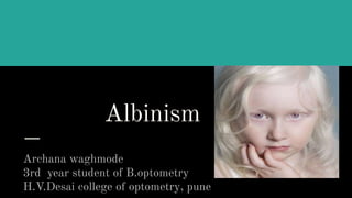 Albinism
Archana waghmode
3rd year student of B.optometry
H.V.Desai college of optometry, pune
 