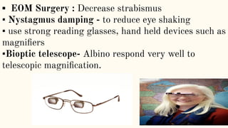 ▪ EOM Surgery : Decrease strabismus
▪ Nystagmus damping - to reduce eye shaking
▪ use strong reading glasses, hand held devices such as
magniﬁers
▪Bioptic telescope- Albino respond very well to
telescopic magniﬁcation.
 