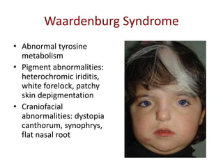 Hypopigmentation Disorders | PPTX