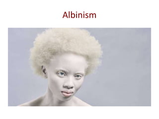 Hypopigmentation Disorders | PPTX