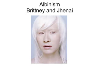 Albinism
Brittney and Jhenai