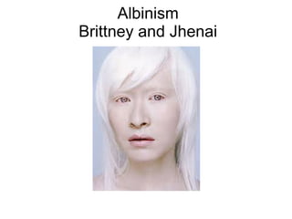 Albinism
Brittney and Jhenai

 