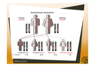 Albinism | PDF