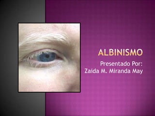 Albinismo Presentado Por:Zaida M. Miranda May 
