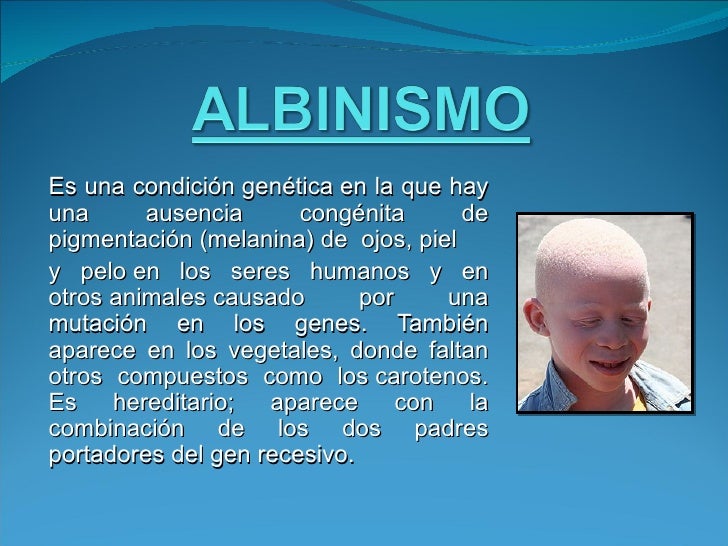 Es una condición genética en la que hayuna      ausencia      congénita      depigmentación (melanina) de ojos, piely pelo...