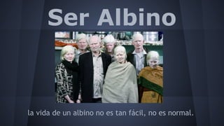 Ser Albino

la vida de un albino no es tan fácil, no es normal.

 