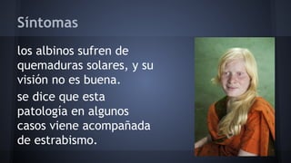 Síntomas
los albinos sufren de
quemaduras solares, y su
visión no es buena.
se dice que esta
patología en algunos
casos viene acompañada
de estrabismo.

 