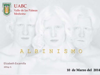 UABC
Valle de las Palmas
Medicina
Elizabeth Escamilla
2014-1
10 de Marzo del 2014
A L B I N I S M O
 