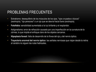PROBLEMAS FRECUENTES
• Estrabismo: desequilibrio de los músculos de los ojos, "ojos cruzados o bizcos"
(esotropía), "ojo perezoso" o un ojo que se desvía hacia fuera (exotropía).
• Fotofobia: sensibilidad aumentada a la luz brillante y el resplandor.
• Astigmatismo: error de refracción causado por una imperfección en la curvatura de la
córnea, lo que impide el enfoque claro de los objetos cercanos.
• Hipoplasia foveal: falta de desarrollo de la fóvea del ojo y del nervio óptico.
• Trayectoria anormal del nervio óptico: las señales nerviosas que viajan desde la retina
al cerebro no siguen las rutas habituales.
 