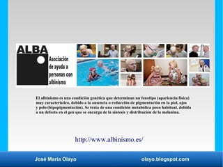 José María Olayo olayo.blogspot.com
El albinismo es una condición genética que determinan un fenotipo (apariencia física)
muy característico, debido a la ausencia o reducción de pigmentación en la piel, ojos
y pelo (hipopigmentación). Se trata de una condición metabólica poco habitual, debida
a un defecto en el gen que se encarga de la síntesis y distribución de la melanina.
http://www.albinismo.es/
 