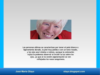 José María Olayo olayo.blogspot.com
Las personas albinas se caracterizan por tener el pelo blanco o
ligeramente dorado, la...