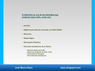 José María Olayo olayo.blogspot.com
El albinimso es una de las patologías que
producen baja visión, junto con:
- Aniridia
...