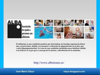 José María Olayo olayo.blogspot.com
El albinismo es una condición genética que determinan un fenotipo (apariencia física)
...