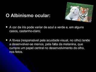 O Albinismo ocular: A cor da íris pode variar de azul a verde e, em alguns casos, castanho-claro;  A fóvea (responsável pela acuidade visual, no olho) tende a desenvolver-se menos, pela falta da melanina, que cumpre um papel central no desenvolvimento do olho, nos fetos. 
