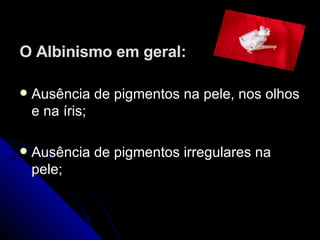 O Albinismo em geral: Ausência de pigmentos na pele, nos olhos e na íris; Ausência de pigmentos irregulares na pele; 
