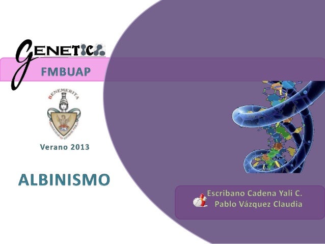 DEFINICIÓN
Ausencia total/parcial de melanina
Piel
Pelo
Ojos
Defecto congénito
en la producción y
transferencia
de melanin...