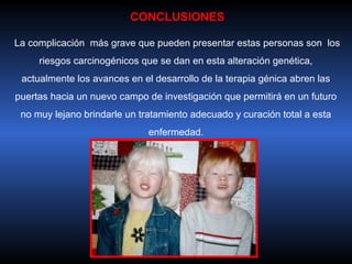 CONCLUSIONES

La complicación más grave que pueden presentar estas personas son los
     riesgos carcinogénicos que se dan en esta alteración genética,
 actualmente los avances en el desarrollo de la terapia génica abren las
puertas hacia un nuevo campo de investigación que permitirá en un futuro
 no muy lejano brindarle un tratamiento adecuado y curación total a esta
                              enfermedad.
 