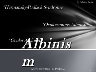 By Sabrina Basile

*Hermansky-Pudlack Syndrome


                      *Oculocantous Albinism



        Albinis
  *Ocular Albinism



        m    Affects more than Just People….                1
 