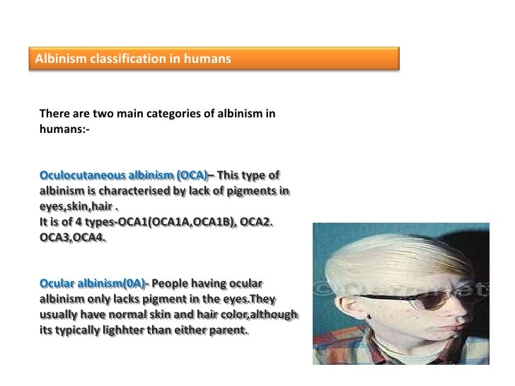 a description of oculocutaneous albinism which involves the absence of melanin In humans, there are two principal types of albinism: oculocutaneous, affecting the eyes, skin and hair, and ocular affecting the eyes only most people with oculocutaneous albinism appear white or very pale, as the melanin pigments responsible for brown, black, and some yellow colorations are not present. a description of oculocutaneous albinism which involves the absence of melanin In humans, there are two principal types of albinism: oculocutaneous, affecting the eyes, skin and hair, and ocular affecting the eyes only most people with oculocutaneous albinism appear white or very pale, as the melanin pigments responsible for brown, black, and some yellow colorations are not present.