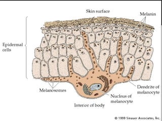 albinism | PPT