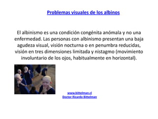 Problemas visuales de los albinos El albinismo es una condición congénita anómala y no una enfermedad. Las personas con albinismo presentan una baja agudeza visual, visión nocturna o en penumbra reducidas, visión en tres dimensiones limitada y nistagmo (movimiento involuntario de los ojos, habitualmente en horizontal). www.bittelman.cl Doctor Ricardo Bittelman 