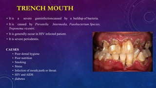 ALBIN TT oralcavity.pptx.pdf
