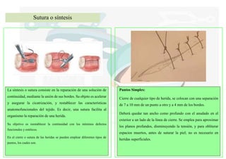 La síntesis o sutura consiste en la reparación de una solución de
continuidad, mediante la unión de sus bordes. Su objeto es acelerar
y asegurar la cicatrización, y restablecer las características
anatomofuncionales del tejido. Es decir, una sutura facilita al
organismo la reparación de una herida.
Su objetivo es reestablecer la continuidad con los mínimos defectos
funcionales y estéticos.
En el cierre o sutura de las heridas se pueden emplear diferentes tipos de
puntos, los cuales son.
Puntos Simples:
Cierre de cualquier tipo de herida, se colocan con una separación
de 7 a 10 mm de un punto a otro y a 4 mm de los bordes.
Deberá quedar tan ancho como profundo con el anudado en el
exterior a un lado de la línea de cierre. Se emplea para aproximar
los planos profundos, disminuyendo la tensión, y para obliterar
espacios muertos, antes de suturar la piel; no es necesario en
heridas superficiales.
Sutura o síntesis
 