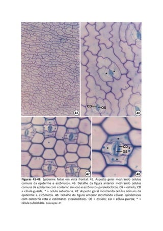*     *




                                                     CD          OS
                                           45                                                 46




                                                                               *
                                                                                   CD
                                                                      *            OS
                                                                                      *

                                                                               *

                                                     47                                       48
Figuras  45‐48.  Epiderme  foliar  em  vista  frontal.  45.  Aspecto  geral  mostrando  células 
comuns  da  epiderme  e  estômatos.  46.  Detalhe  da  figura  anterior  mostrando  células 
comuns da epiderme com contorno sinuoso e estômatos paralelocíticos. OS = ostíolo; CD 
=  célula‐guarda;  *  =  célula  subsidiária.  47.  Aspecto  geral  mostrando  células  comuns  da 
epiderme  e  estômatos.  48.  Detalhe  da  figura  anterior  mostrando  células  epidérmicas 
com  contorno  reto  e  estômatos  estaurocíticos.  OS  =  ostíolo;  CD  =  célula‐guarda;  *  = 
célula subsidiária. Coloração: AT.
 