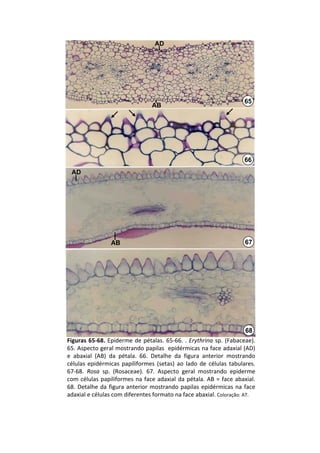 AD




                                                                           65
                                    AB




                                                                           66
 AD




                  AB                                                        67




                                                                            68
Figuras  65‐68.  Epiderme  de  pétalas.  65‐66.  .  Erythrina sp.  (Fabaceae). 
65. Aspecto geral mostrando papilas  epidérmicas na face adaxial (AD) 
e  abaxial  (AB)  da  pétala.  66.  Detalhe  da  figura  anterior  mostrando 
células  epidérmicas  papiliformes (setas)  ao  lado  de  células  tabulares. 
67‐68.  Rosa sp.  (Rosaceae).  67.  Aspecto  geral  mostrando  epiderme 
com  células  papiliformes na  face  adaxial  da  pétala.  AB  =  face  abaxial. 
68.  Detalhe  da  figura  anterior  mostrando  papilas  epidérmicas  na  face 
adaxial e células com diferentes formato na face abaxial. Coloração: AT.
 