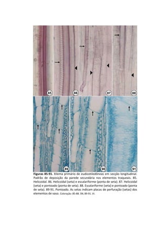 85                  86                        87                  88




                         89                          90                      91
Figuras  85‐91.  Xilema  primário  de  eudicotiledôneas em  secção  longitudinal. 
Padrão  de  deposição  da  parede  secundária  nos  elementos  traqueais.  85. 
Helicoidal. 86. Helicoidal (seta) e escalariforme (ponta de seta). 87. Helicoidal 
(seta) e pontoado (ponta de seta). 88. Escalariforme (seta) e pontoado (ponta 
de seta). 89‐91. Pontoado. As setas indicam placas de perfuração (setas) dos 
elementos de vaso. Coloração: 85‐88. SN; 89‐91. VI.
 