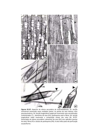 EV


                                                                   *               *



                                                         *                           93




                                    92




                            FI
          EV                                                                     R


                                    95                                               94

                                  FI



                     EV



                            PA                             96                        97
Figuras  92‐97.  Aspectos  do  xilema  secundário  de  eudicotiledôneas.  92.  Secção 
transversal  mostrando  vasos  múltiplos  (setas).  As  pontas  de  seta  indicam  raios 
parenquimáticos. 93. Secção longitudinal tangencial mostrando raios estratificados 
multisseriados (*),  elementos de vaso (EV), parênquima axial e fibras. 94. Secção 
longitudinal  radial  mostrando  a  composição  celular  dos  raios  (R).  95‐97. 
Dissociados do  xilema  secundário:  elementos  de  vaso (EV)  com apêndice  (pontas 
de seta), fibras (FI) e células de parênquima (PA). A seta indica placa de perfuração 
escalariforme.
 