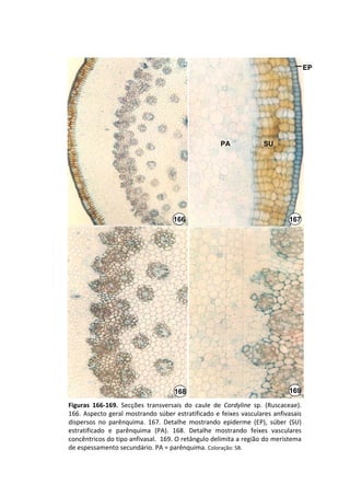 EP




                                                         PA               SU




                                       166                                         167




                                        168                                        169

Figuras  166‐169.  Secções  transversais  do  caule  de  Cordyline sp.  (Ruscaceae). 
166.  Aspecto  geral  mostrando  súber  estratificado  e  feixes  vasculares  anfivasais 
dispersos  no  parênquima.  167.  Detalhe  mostrando  epiderme  (EP),  súber  (SU) 
estratificado  e  parênquima  (PA).  168.  Detalhe  mostrando  feixes  vasculares 
concêntricos do tipo anfivasal.  169. O retângulo delimita a região do meristema 
de espessamento secundário. PA = parênquima. Coloração: SB.
 