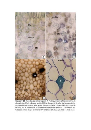 Clo



                   Clo



                                                               CRi
                       GA
                                                                        GA


                             CRi



                                          7                                             8
                                                                  GA




                            ID

                                                                   ID



             CRi



                                           9                                           10
Figuras 7‐10. Aspectos da célula vegetal. 7. Parênquima clorofiliano mostrando 
cloroplastos  (Clo),  grãos  de  amido  (GA)  e  drusas.  8.  Detalhe  da  figura  anterior 
mostrando cloroplastos (Clo), grãos de amido (GA) e cristais (CRi) em forma de 
drusa  (Cri).  9.  Idioblastos  (ID)  contendo  composto  fenólico.    Cri=  cristal.  10. 
Grãos de amido (GA) e idioblasto (ID) fenólico. (ST). Coloração: 7.SC; 8 e 9. LG; 10.AT.
 