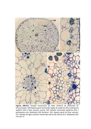 EP
                                                      EP


                                        PA




                            FV



                                                                          ID



                                                         208                             209




                                                                            ID


                                                           X
                                                                                     F




                                       210                                               211
Figuras  208‐211. Secções  transversais  da  folha  cilíndrica  de  Kalanchoe sp. 
(Crassulaceae). 208 Aspecto geral mostrando região da epiderme (EP), parênquima 
aqüífero  (PA)  e  feixe  vascular  central.  209.  Detalhe  mostrando  epiderme  (EP)  e 
parênquima  com  idioblastos  (ID)  fenólicos.  210.  Aspecto  geral  do  feixe  vascular. 
211. Detalhe da figura anterior mostrando xilema (X), floema (F) e idioblastos (ID). 
Coloração: AT
 